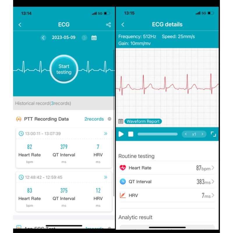 ET540 Smartwatch Fitness Tracker: Blutzucker EKG Bluetooth-Anruf Medizinische KI-Diagnose 1.85