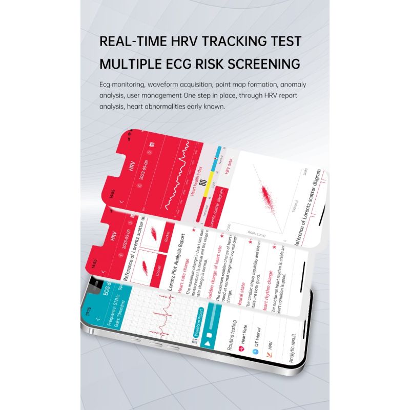 ET540 Smartwatch Fitness Tracker: Blutzucker EKG Bluetooth-Anruf Medizinische KI-Diagnose 1.85