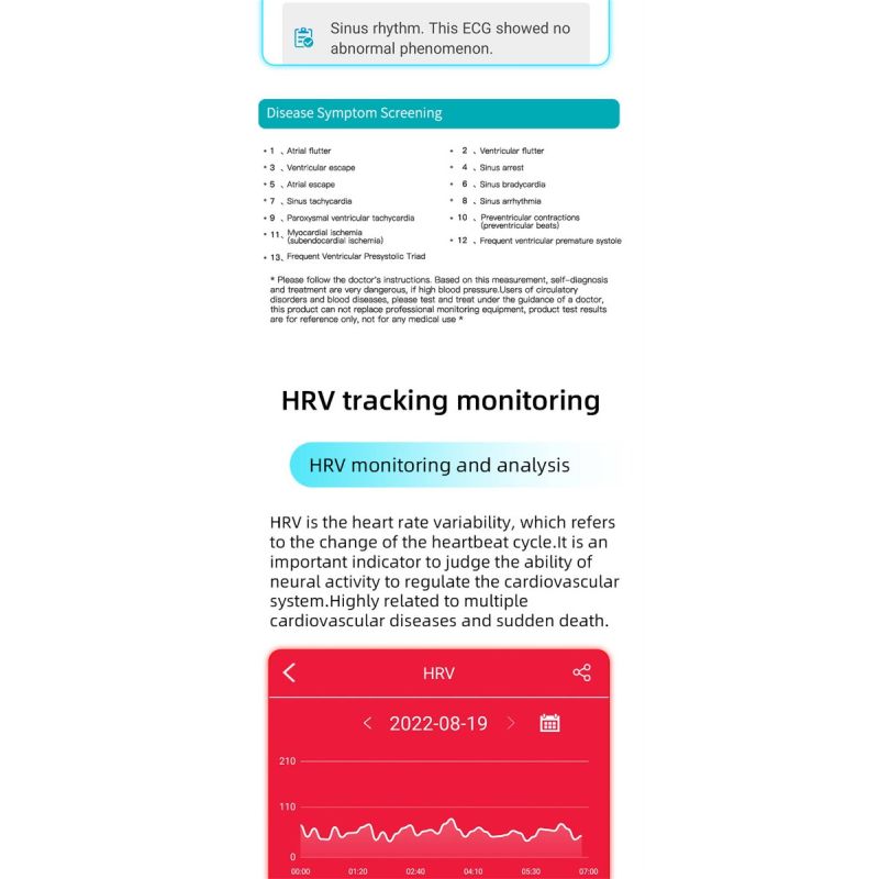 EP01 Smartwatch Blutzucker EKG PPG HRV: Herzfrequenz, Temperatur, Fitness-Tracker, wasserdicht für Gesundheit