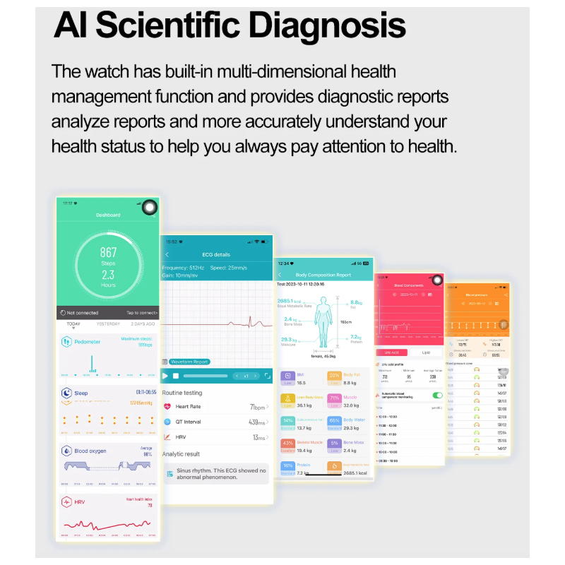 E580 Smartwatch: Blutzucker, EKG, Herzfrequenz, Blutdruck - IP68 Gesundheitsuhr
