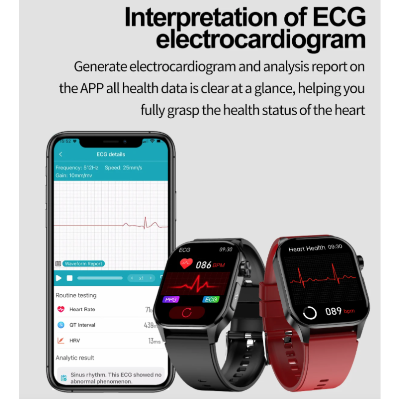 E580 Smartwatch: Blutzucker, EKG, Herzfrequenz, Blutdruck - IP68 Gesundheitsuhr