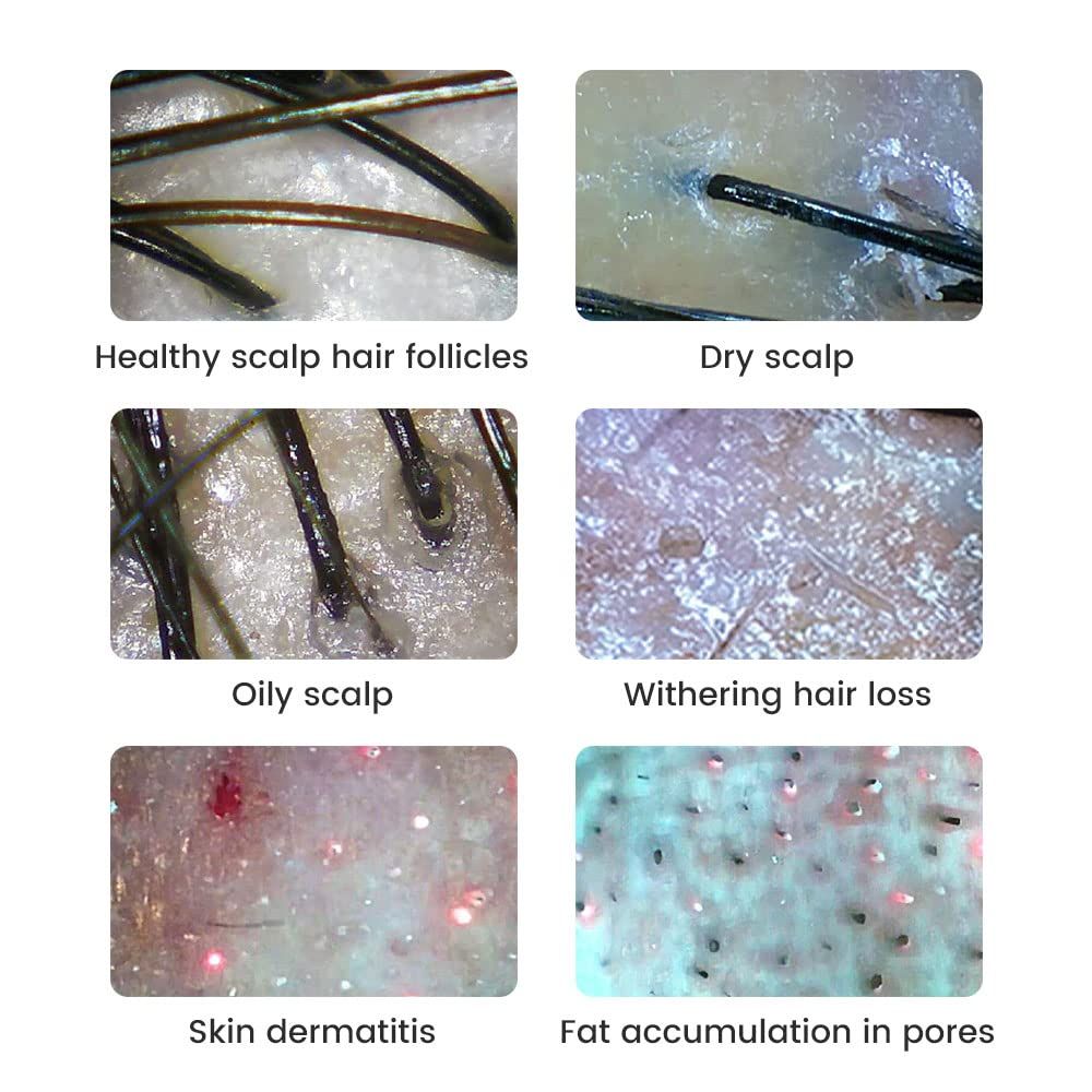 500x Vergrößerung Digitalmikroskop 2MP Vergrößerungsglas Elektronikreparatur Video Münzen Mikroskop Hand-Dermatoskop Hautanalysegerät