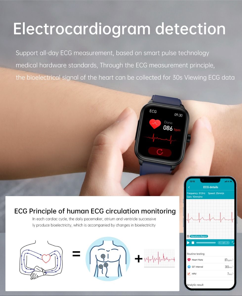 ET540 Blutzucker EKG Körpertemperatur Blutdruck Blutsauerstoff Herzfrequenz Bluetooth-Anruf Smartwatch Fitness-Tracker