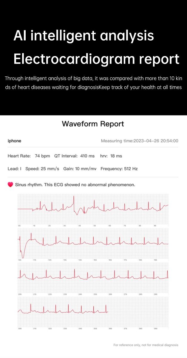 ET540 Blutzucker EKG Körpertemperatur Blutdruck Blutsauerstoff Herzfrequenz Bluetooth-Anruf Smartwatch Fitness-Tracker