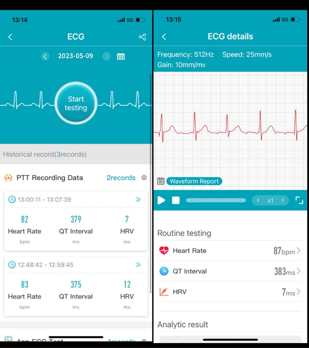 ET540 Blutzucker EKG Körpertemperatur Blutdruck Blutsauerstoff Herzfrequenz Bluetooth-Anruf Smartwatch Fitness-Tracker