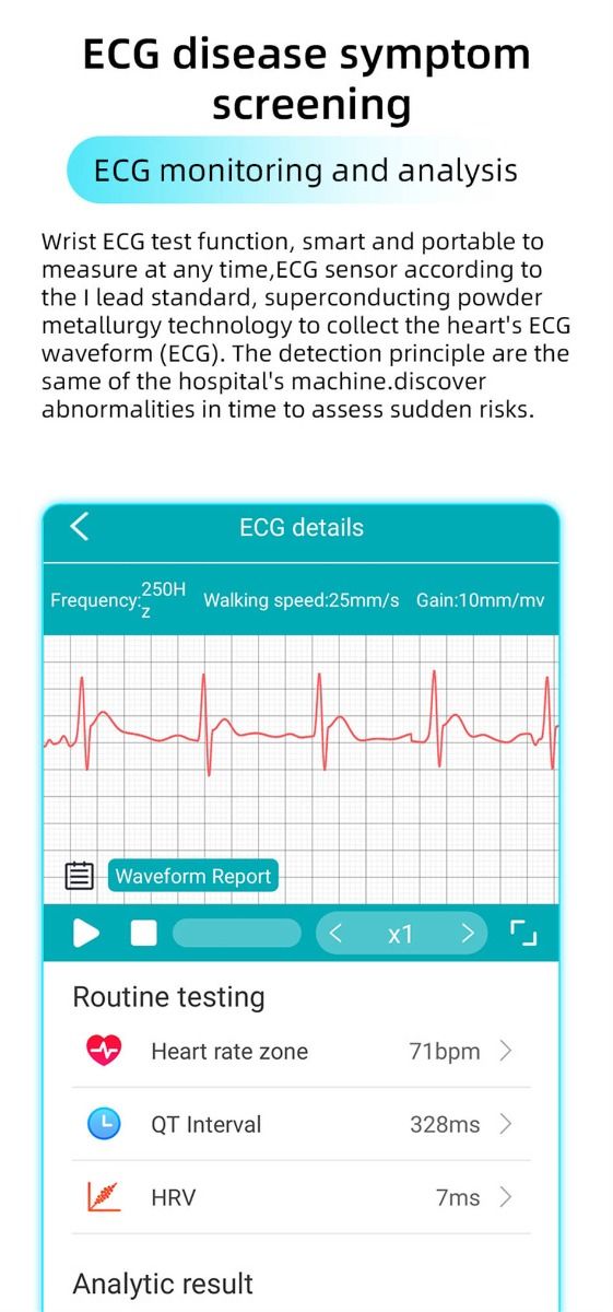 EP01 Blutglukose-Smartwatch: EKG, HRV, Herzfrequenz, Temperatur. 1,47 Zoll HD wasserdichter Fitness-Tracker