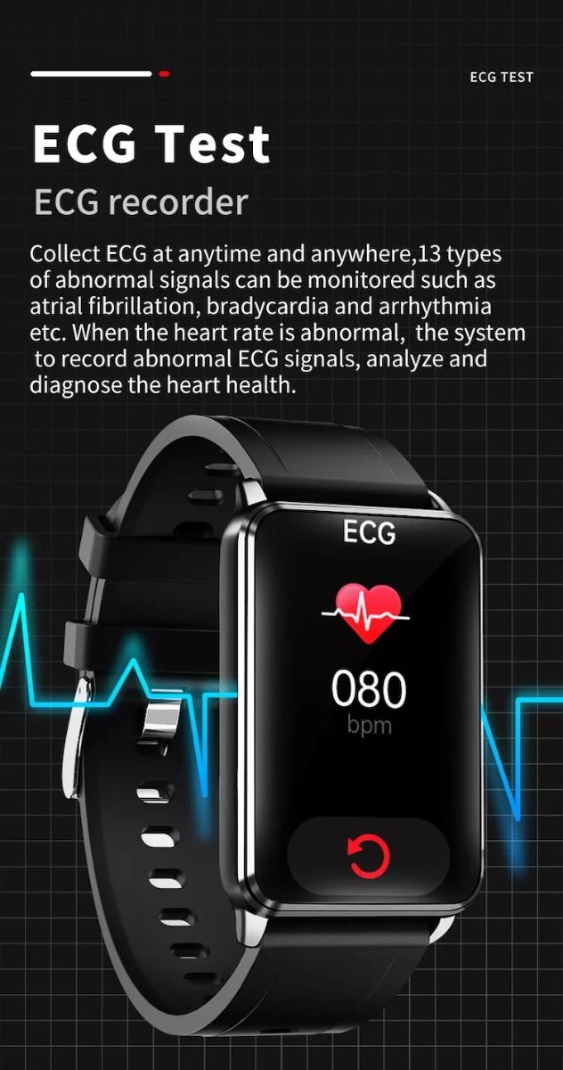 EP02 Blutzucker Smartwatch EKG HRV Herzfrequenz Temperatur 1,57 Zoll HD wasserdicht Smart-Armband Fitness-Tracker
